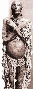 木乃伊被强奸并怀孕，胎儿已经有8个月大()